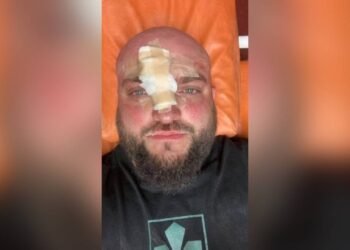У Затоці жорстоко побили ветерана АТО: у поліції уточнили, ким насправді є потерпілий