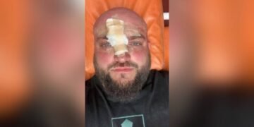 У Затоці жорстоко побили ветерана АТО: у поліції уточнили, ким насправді є потерпілий
