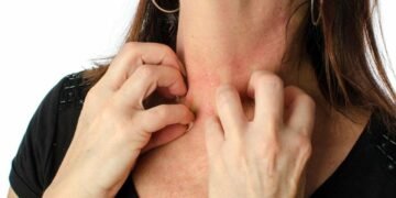 Суха шкіра: що допоможе позбутися лущення та стягнутості